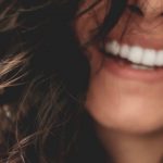 smile lines